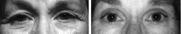eyes_langdon_ba1 Eyes_langdon_ba1