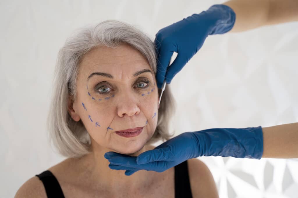 front-view-senior-woman-with-marker-traces - The Shoreline Center for Laser & Cosmetic Surgery
