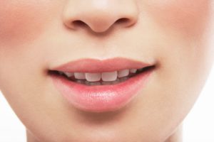 Upper Lip Lift Guilford, CT - The Shoreline Center for Laser & Cosmetic Surgery Upper lip lift guilford, ct