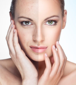 Treat Sun Damaged Skin in Guilford, CT