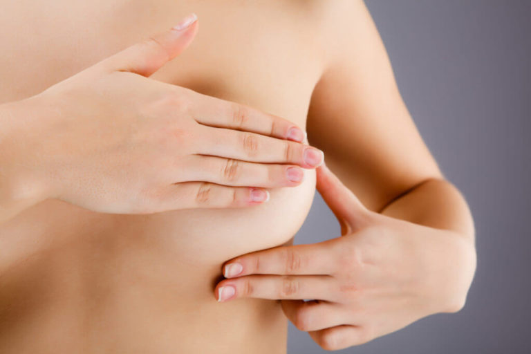 Does Breast Reduction Surgery Always Leave Scars