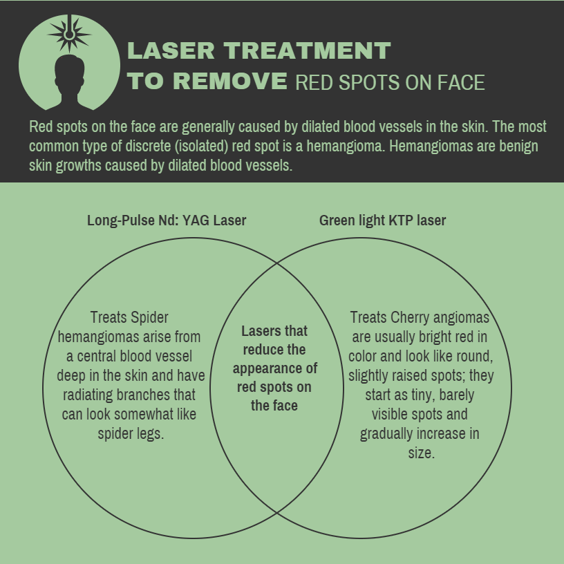 Laser Treatments for Red Spots Guilford