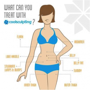 Coolsculpting from The Langdon Center in Guilford, CT