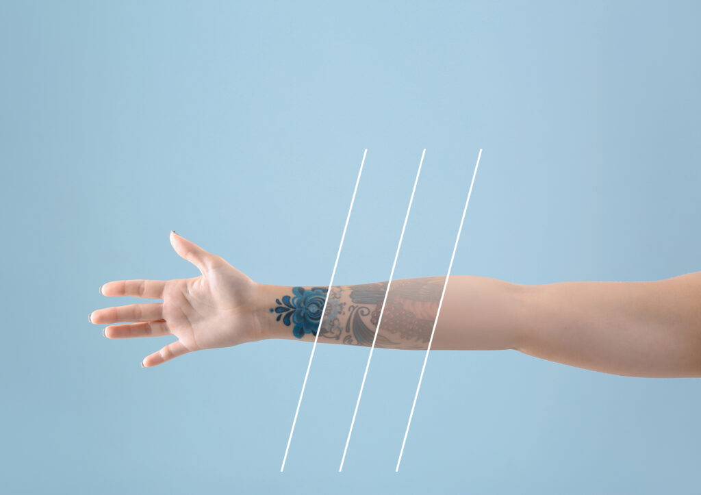 Tattoo Removal Guilford - The Shoreline Center for Laser & Cosmetic Surgery Tattoo removal guilford