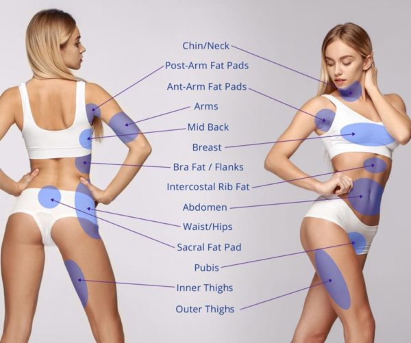 Liposuction Consultation Guilford