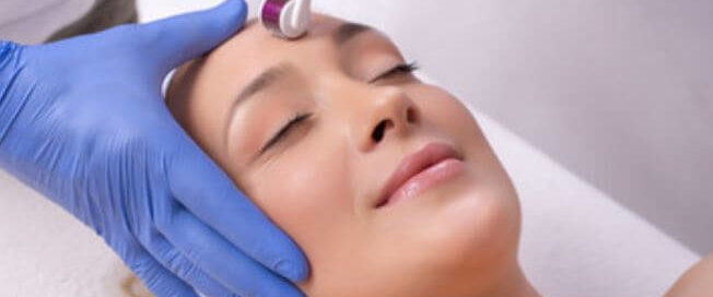 Microneedling Guilford