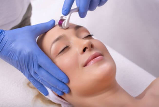 Benefits of Microneedling with PRP