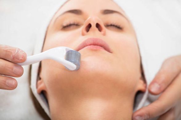 Microneedling Guilford - The Shoreline Center for Laser & Cosmetic Surgery Guilford microneedling