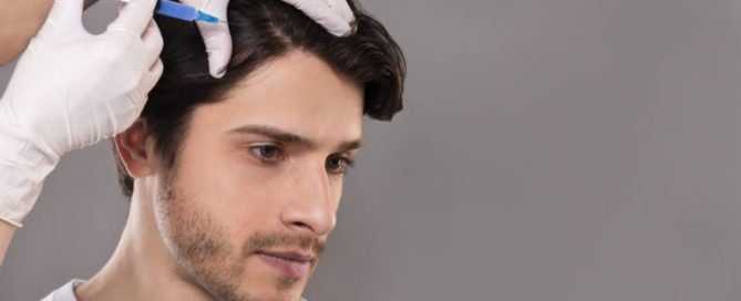 FUE Hair Transplant Guilford