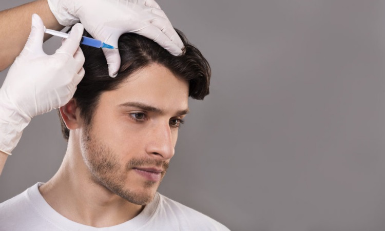 FUE Hair Transplant Guilford