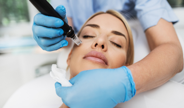 Microneedling Guilford