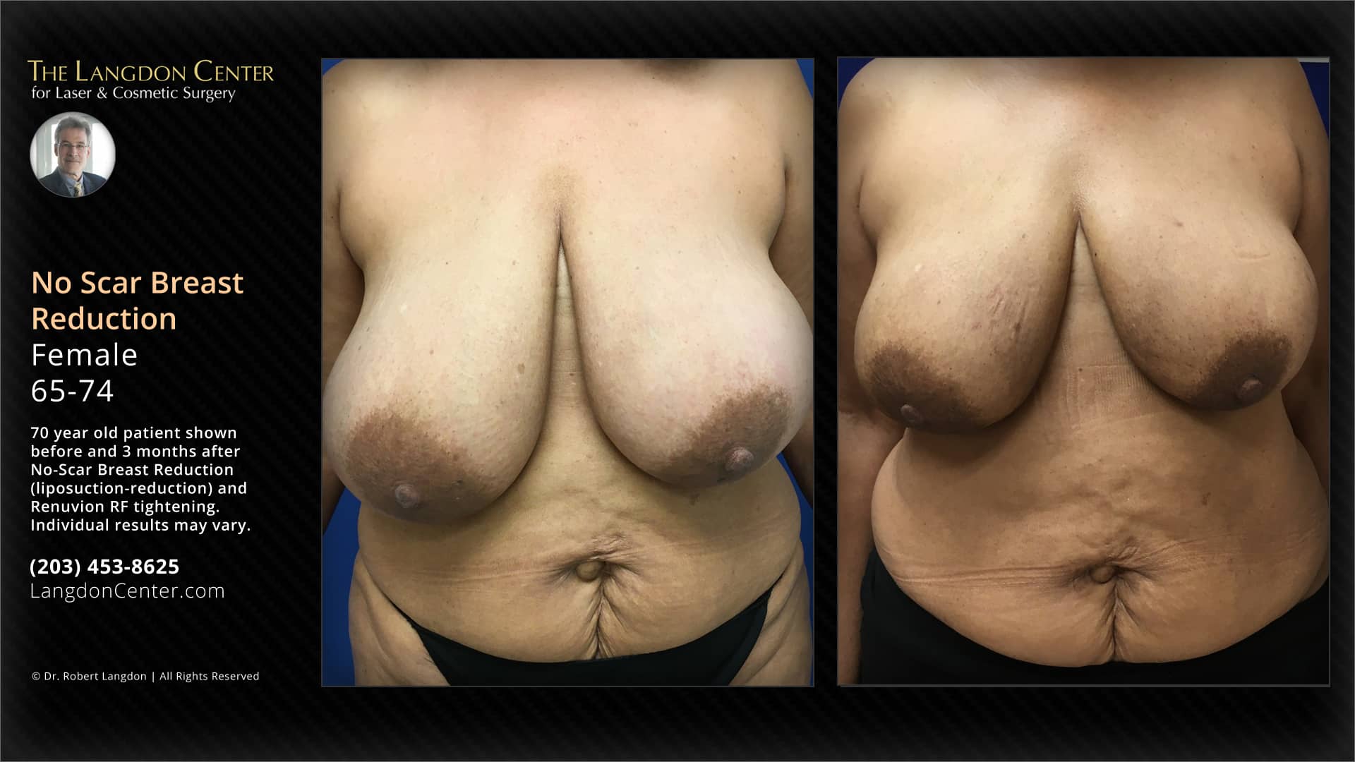 Case 23250