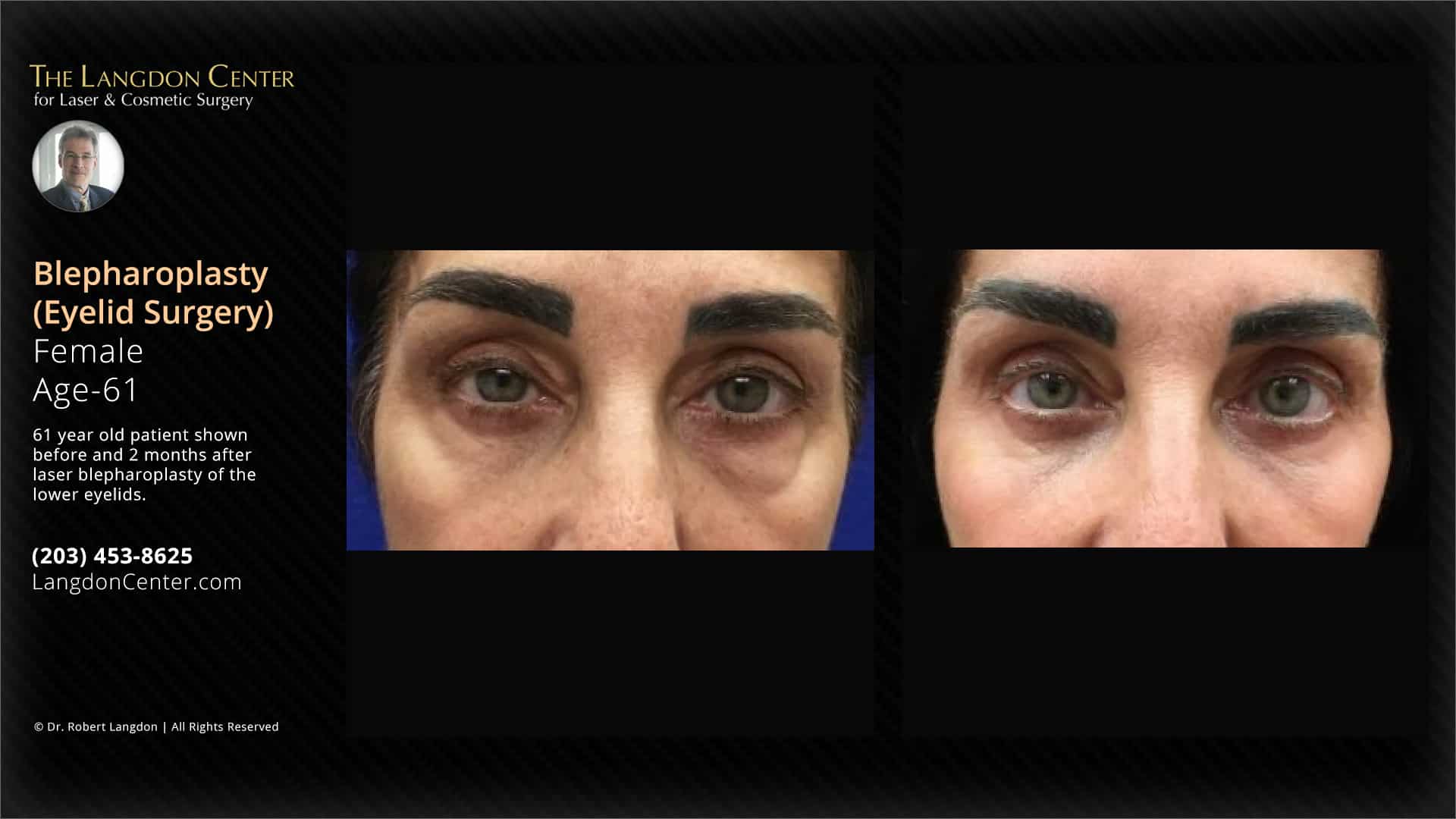 Case 25893