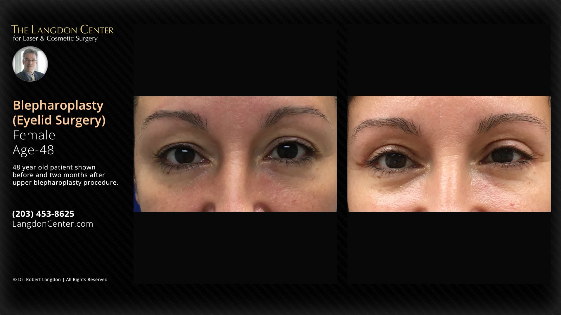 Case 23173