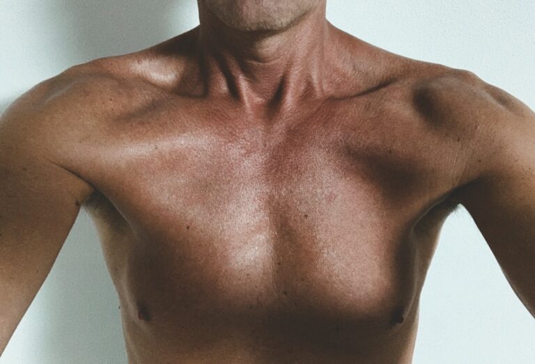 Liposuction for men