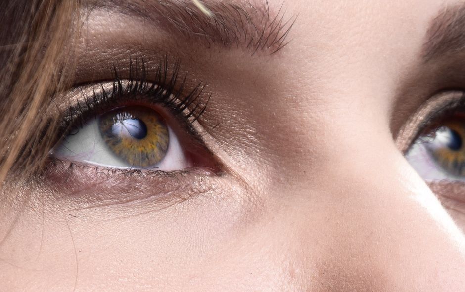 Blepharoplasty
